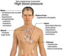 hypertension treatment is aimed at controlling blood pressure in order to protect from damage critical organs which includes the brain, heart, kidneys and eyes.