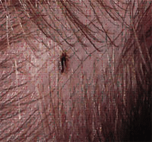 How To Get Rid Of Head Lice